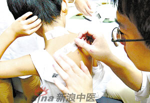 灸法的種類  你知道多少？