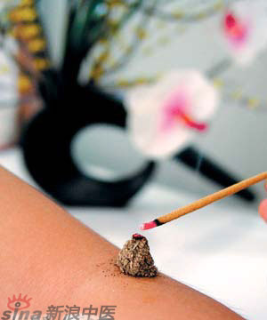節(jié)氣灸” 冬至，你灸了嗎？